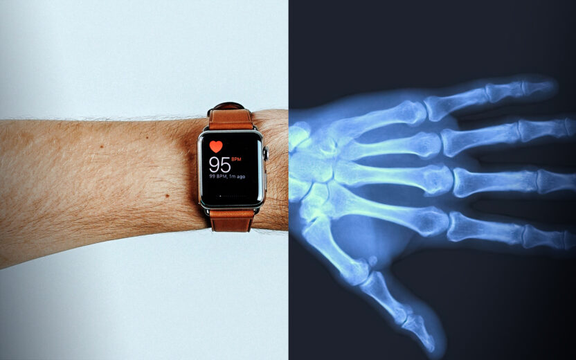 HS174 Archus Image 13d